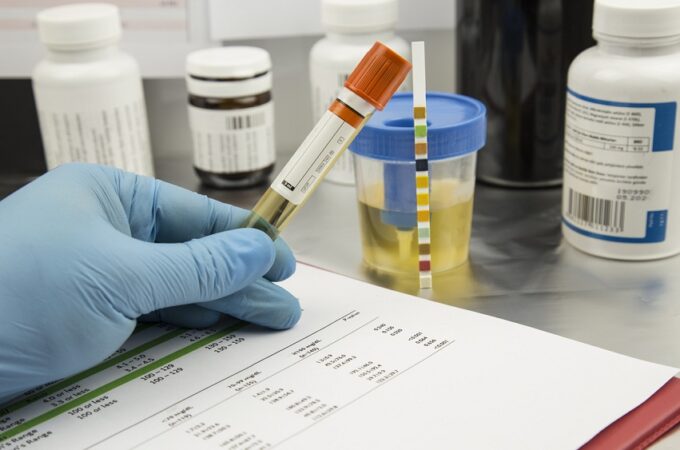 What is drug test?and its causes