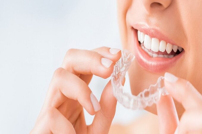 The Importance of Customised Treatment Plans in Invisalign